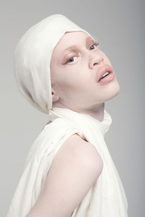 Albino Caucasian